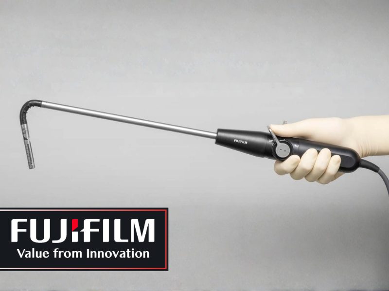 FUJIFILM’s New Laparoscopic Linear Transducer for Ultrasound