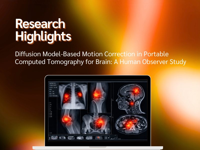 Research Highlight 1 RN Diffusion Model Based Motion Correction in Portable Computed Tomography for Brain A Human Observer Study