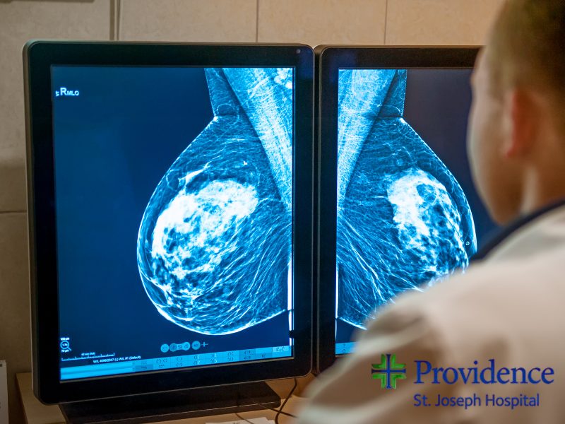 AI Mammogram Technology Offers 23% Greater Cancer Detection, Fewer False Positives