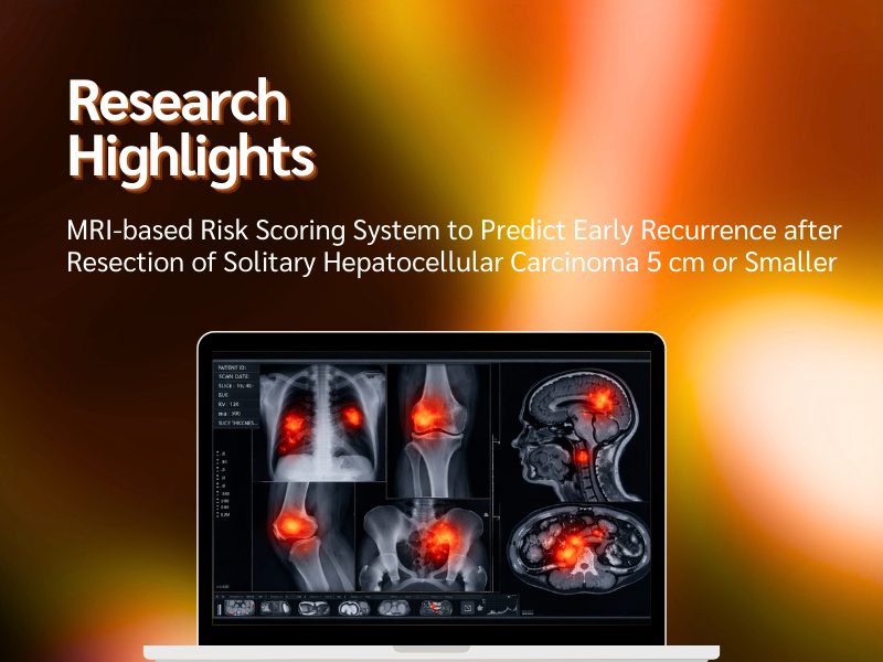 Research Highlight RN MRI based Risk Scoring System to Predict Early Recurrence after Resection of Solitary Hepatocellular Carcinoma 5 cm or Smaller